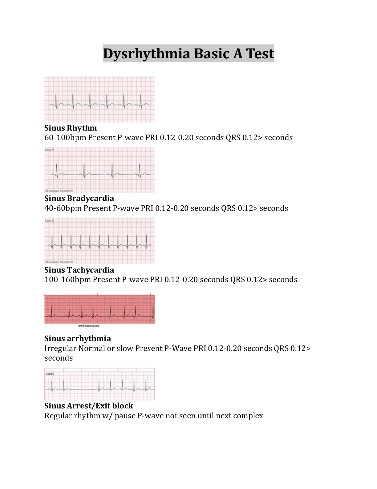 Preview image for Dysrhythmia Basic A Test Questions And Answers